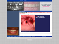 http://www.implantdentairetunisie.com/